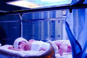 Jaundice in a newborn baby and its treatment